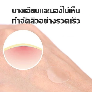 แผ่นสติกเกอร์ไฮโดรคอลลอยด์ กันน้ํา สีม่วง หลากสีสัน สําหรับติดสิวเสี้ยน มี 28 ชิ้น