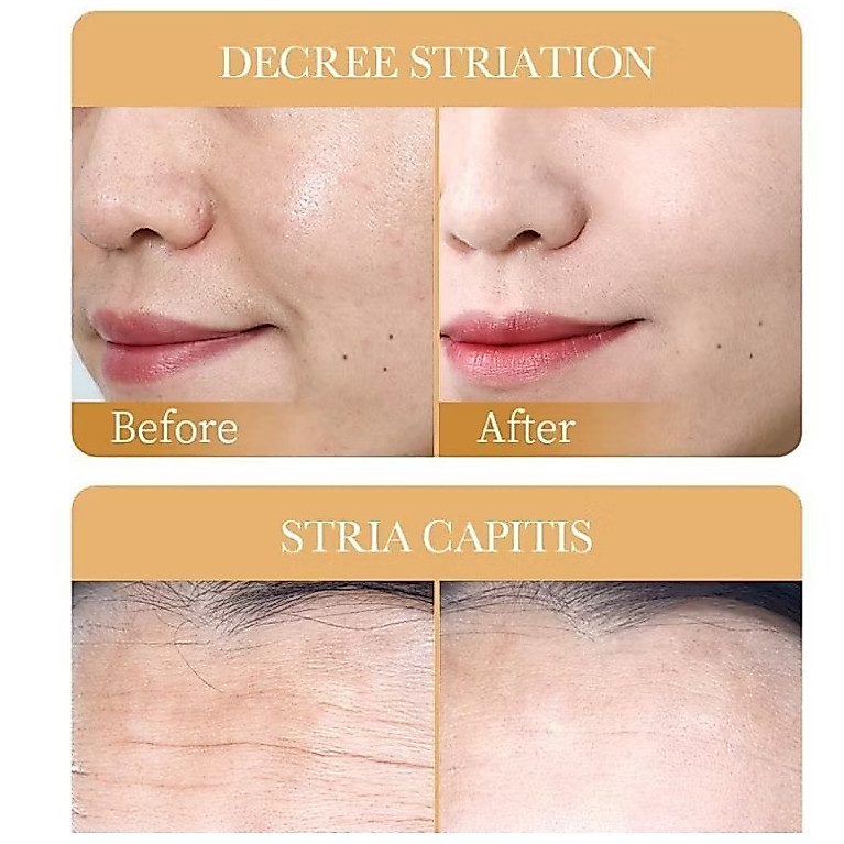SADOER (ซาดูเออร์) Collagen Facial Mask I 1 แผ่น I มาส์กคอลลาเจนไวท์เทนนิ่งต่อต้านริ้วรอย — صورة 6