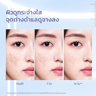 SKINTIFIC 377 Dark Spot Essence Toner ลบเลือนจุดด่างดำ สว่างขึ้น ตั้งแต่ 14 วันที่ใช้ โทนเนอร์แพด โทนเนอร์ น้ำตบ