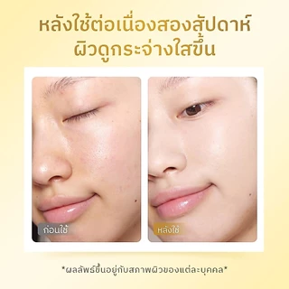 The Originote Hyalu-C Serum - เซรั่มไฮยา วิตซี ช่วยปรับผิวหน้าหมองคล้ำให้กระจ่างใส ให้สีผิวให้สม่ำเสมอ