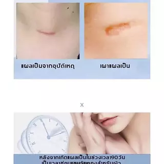 เจลทาผิวใส ขนาด15 กรัม ราคาส่ง แพ็ค4หลอด
