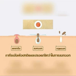 24ชิ้น/กล่อง MQ Corn พลาสเตอร์หูด ตาปลา Corn Plaster Removel เอ็ม คิว พลัส