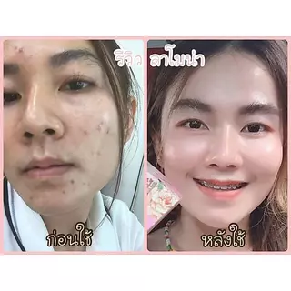 ครีมไข่มุกแท้ ลาโมน่า เพอร์เฟ็ค เดย์ครีม ครีมกลางวัน Lamona Perfect Day Cream ของแท้ 100% รับตรงจากแบรนด์
