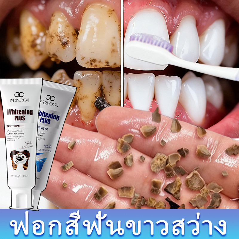 LYDIMOON ยาสีฟันฟันขาว 100g ขจัดคราบเหลือง ฟอกฟันขาวขจัดคราบหินปูน ฟอกฟันขาว ดูแลเหงือก ดับกลิ่นปาก