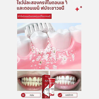 ยาสีฟันโปรไบโอติก SP-10 ลดคราบเหลืองจากชา/กาแฟ ปราศจาก SLS ลดกลิ่นปาก