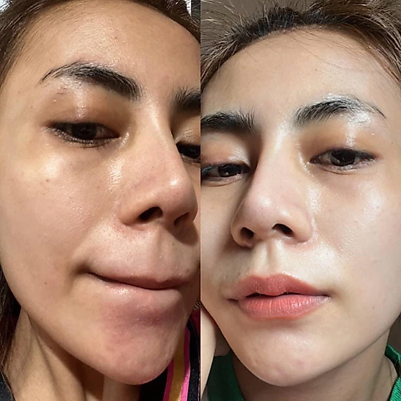 ครีมชมนิสาแบบ 10กระปุก ลดฝ้า กระ จุดด่างดำ ช่วยในเรื่องหน้าเนียนสวยกระจ่างใส ไนท์ครีม สกินแคร์ CHOMNISA thumbnail 3