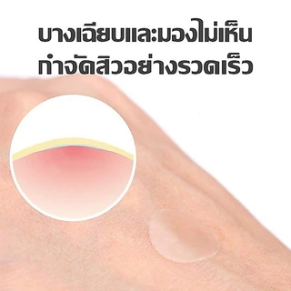แผ่นแปะสิว 140 ดวง(ผสมสี) รูปดาว สีสันสดใส สําหรับติดตกแต่งสิว แผ่นแปะสิวสีซ่อมแซมหลุมสิวและรอยต่างๆ ทำให้สิวจางลง