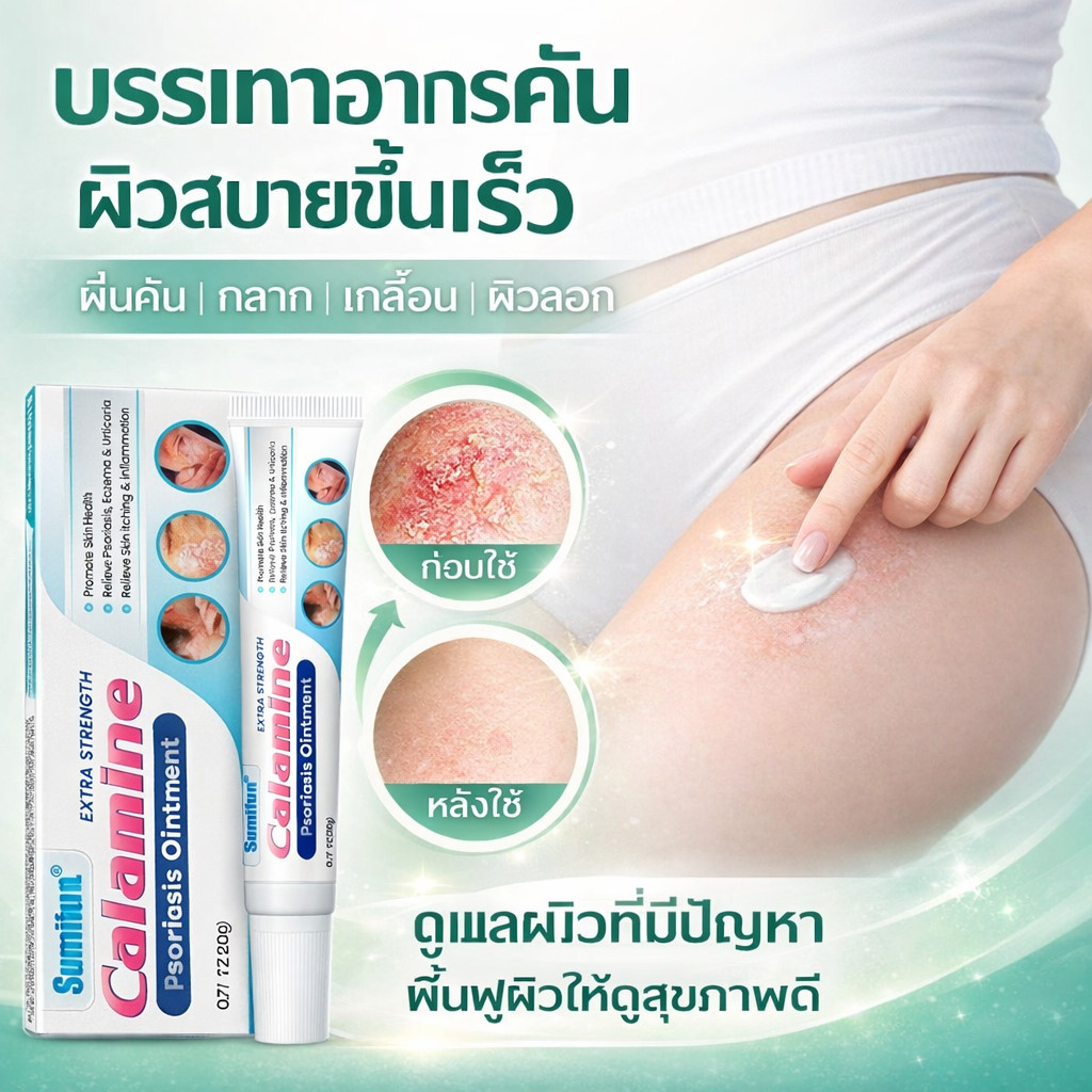 หยุดคันเร็ว ครีมแก้เชื้อรา ช่วยยับยั้งเชื้อรา บรรเทาอาการคันและผิวลอก เนื้อครีมบางเบา