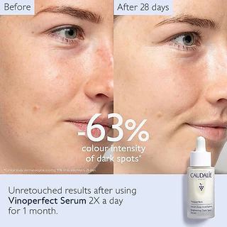 [เหลือ 296.- "เก็บโค้ดทักแชท"] 🔻พร้อมส่ง&แท้🔻 Caudalie Vinoperfect Radiance Serum 10 ml.