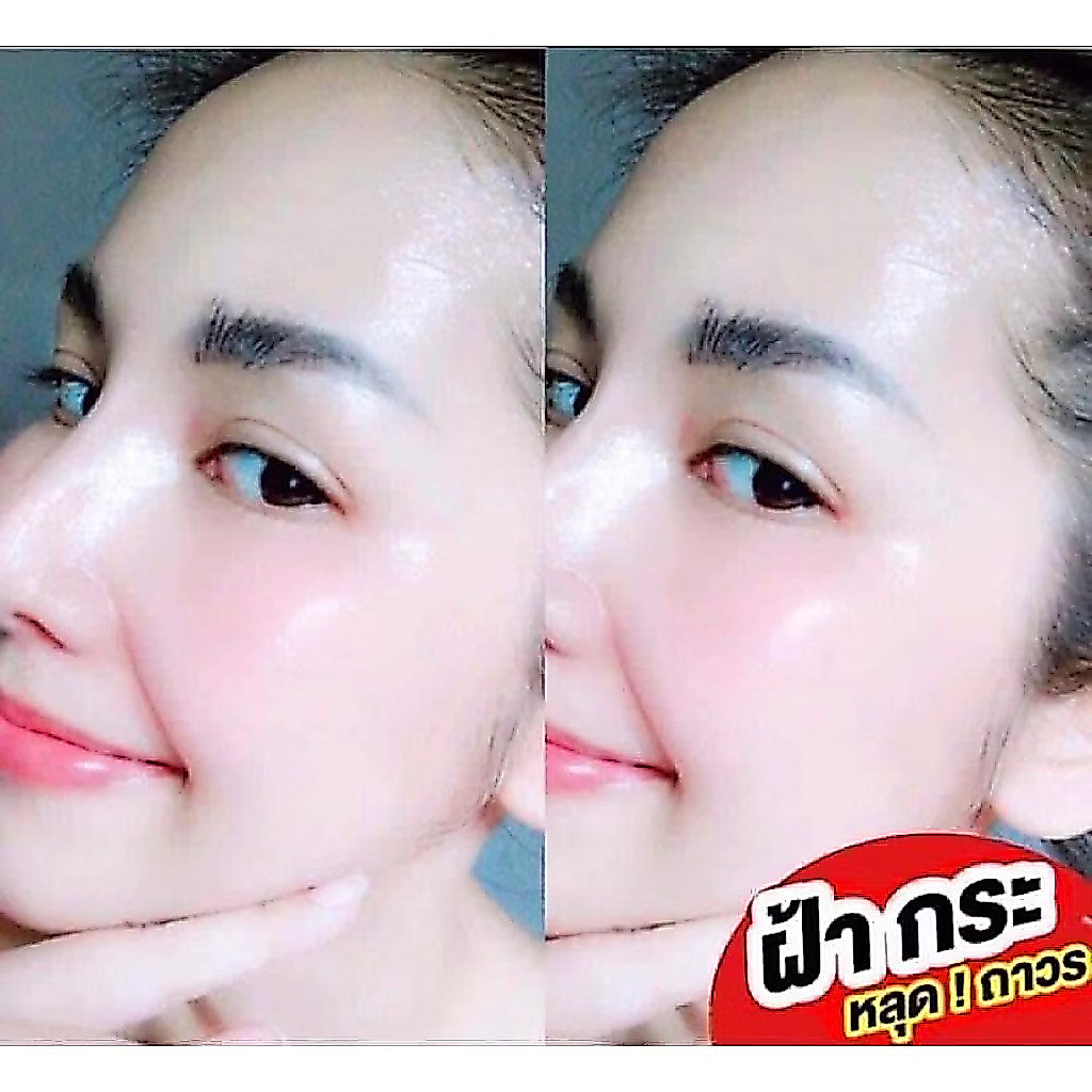 ครีมหน้าวิ้งค์ ของแท้(สูตรคุณหมอ)