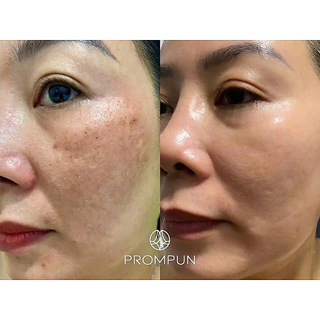 ครีมขมิ้นว่านนางแดง สูตรฝ้า กระ จุดด่างดำ ผิวกระจ่างใส กลางคืน | PROMPUN Turmeric Night Cream 5 g