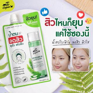 [ลด 15% โค้ด "UX8CFP"]น้ำตบใบเฟิร์น น้ำตบสิว The Original Hyaluron Acne Expert น้ำตบลดสิว