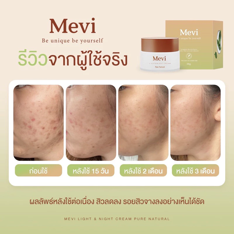 Mevi Moisturizer เมวี่มอยซ์เจอร์ไรเซอร์ 30g thumbnail 3
