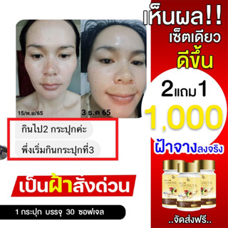 ✅ขายดีอันดับ1แท้💯 จากบริษัทราคานี้เท่านั้น zincolta ซินคอลต้า น้ำมันอาโวคาโดสกัดเย็น คอลลาเจน สิว ฝ้ากระ ผิวแห้ง วัยทอง