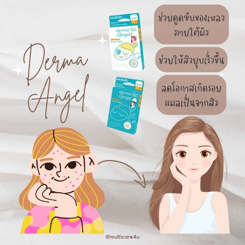 แผ่นดูดซับสิว Derma Angle สูตร Night🌛🌠