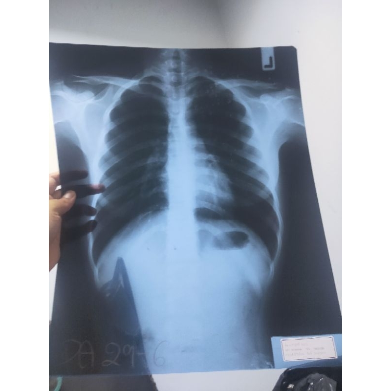 ฟิล์มเอกซเรย์ใช้แล้ว ฟิล์มเอกซเรย์เก่า ฟิล์มเอกซเรย์ ลิ้นแตรลม แผ่นแตร ใช้ประดิษฐ์อื่นๆ used x-xray 