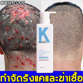 💥แก้อาการคันหนังศรีษะ 1 ขวด💥OUSHLIAN แชมพูขจัดรังแค สำหรับคันหนังศีรษะ แชมพูกําจัดรังแค ยาสระผมขจัดรังแค ยาสระผมรังแค