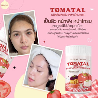 🍅 TOMATAL 🍅 ชงขาวมะเขือเทศ น้ำชงมะเขือเทศ3สี tomatalชงขาว ผิวขาว บำรุงผิวอิ่มน้ำไม่แห้งกร้าน ผงมะเขือเทศเข้มข้น