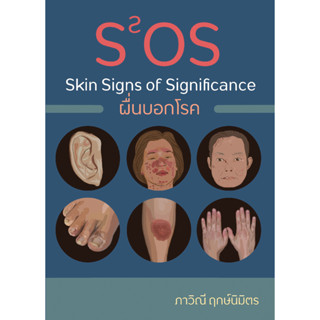 ผื่นบอกโรค Skin Signs of Significance