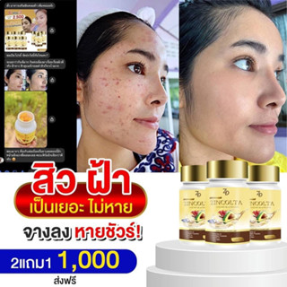 ของแท้ 💯 2 แถม 1 ส่งฟรี zincolta ซินคอลต้า น้ำมันอาโวคาโดสกัดเย็น ผสม คอลลาเจนญี่ปุ่น สิว ฝ้ากระ ผิวแห้ง วิตตามินผิว วัย