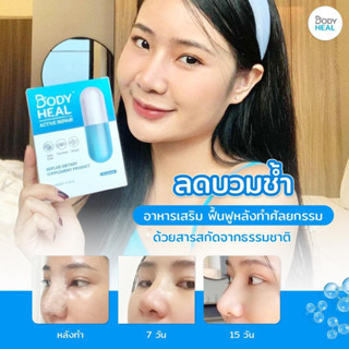 Body Heal (20 แคปซูล) ส่งเสริมสุขภาพผิวหน้า หลังผ่า