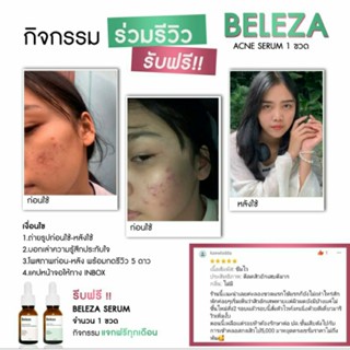 [โค้ดลด 40.- บาท] Beleza Skin Whitening&amp;Acne Serum 15 ml