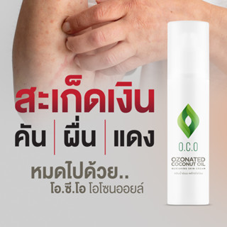 ดูแลสะเก็ดเงิน โอโซนออยล์ OCO นวัตกรรมแห่งอนาคตสำหรับสะเก็ดเงิน ขนาด 100 ml.( OCO OZONE OIL 100ml. )