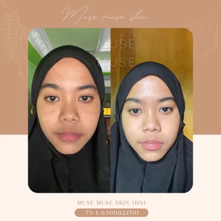MUSE MUSE SKIN สครับมะขามออแกนิค มิวส์มิวส์สกินมาส์กครีมสปา สูตร ออริจินอล