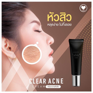 ✨ส่งฟรี ทั่วประเทศไทย ✨ ครีมละลายหัวสิว Clear Acne อับดับ1✨