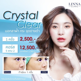 LINNA Crystal Clear 1 Time คริสตัล เคลียร์ ลดฝ้ากระจุดด่างดำ (Crystal Clear) 1 ครั้ง