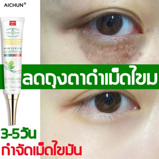 Aichun กำจัดเม็ดไขมัน อายครีม เซรั่มรอบดวงตา 30ml ขจัดฟื้นฟูผิวตา เพิ่มความชุ่มชื่น กำจัดถุงใต้ตา เม็ดไขมัน ครีมบำรุงรอบ