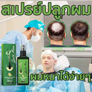 【ราคาพิเศษทุกวัน】South Moon เซรั่มปลูกผม สเปรย์ปลูกผม 100ml ป้องกันผมร่วงอย่างมืออาชีพ แก้ปัญหาผมร่วง ลดผมร่วง