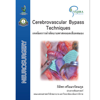 เทคนิคการผ่าตัดบายพาสหลอดเลือดสมอง Cerebrovascular Bypass Techniques