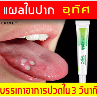 พร้อมส่ง!! ครีมทาแผลในปาก Oral care 20กรัม แผลในช่องปากเจล ช่วยแก้ปัญหาลิ้นเป็นฟอง แสบปาก เหงือกบวม ปวด