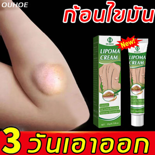 แท้ [South Moon] ออกแบบ36ชนิดของไขมันใต้ผิวหนังกำจัดมวลก้อนไปยังถุงน้ำ Lymph Care Ointment สมุนไพรกำจัด ก้อนเนื้อใต้ผิวห