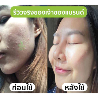 DR.NAME X Perfect Plant ครีมรักษาสิว ลดสิว สิวอักเสบ สิวอุดตัน สิวติดสาร สิวผด สิวฮอร์โมน รอยสิว 15g