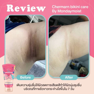(1แถม1) ครีมทา รักแร้ ขาหนีบ ก้น CHERMARN BIKINI CARE สูตรอ่อนโยน ค่าpH3.5 ขาวขึ้นใน 7 วัน*
