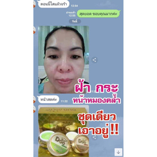 ครีมดูโอ้โกลด์💥มีเก็บเงินปลายทาง💥ราคาถูก🎉