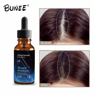 Bunee hair growth Serum เซรั่มบำรุงหนังศรีษะปลูกเส้นผมใหม่