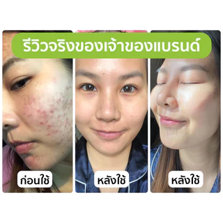 DR.NAME X Perfect Plant ครีมรักษาสิว ลดสิว สิวอักเสบ สิวอุดตัน สิวติดสาร สิวผด สิวฮอร์โมน รอยสิว 15g