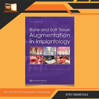 Bone and Soft Tissue Augmentation in Implantology