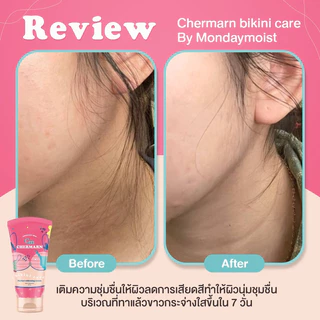 (1แถม1) ครีมทา รักแร้ ขาหนีบ ก้น CHERMARN BIKINI CARE สูตรอ่อนโยน ค่าpH3.5 ขาวขึ้นใน 7 วัน*
