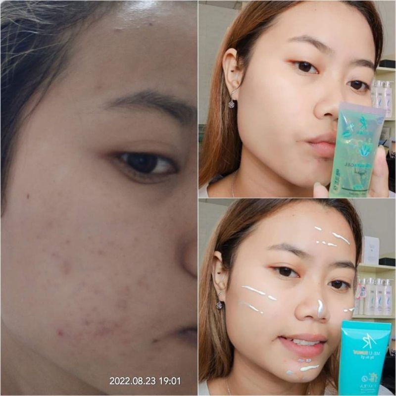 I Aura SunScreen + Gel