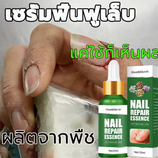 West&amp;Monthเซรั่มบำรุงเล็บ30ml รักษาเล็บเสีย รักษารคเชื้อราที่เล็บ เล็บพัง เล็บขบ เซรั่มบำรุงเล็บ ยาฆ่าเชื้อราเล็บ