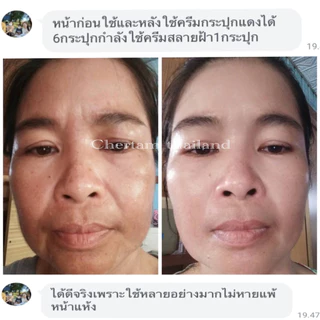 [ 1 แถม 1 ] ครีมโสมสลายฝ้า By หนูเล็กก่อนบ่าย