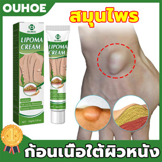 แท้OUHOE ออกแบบ36ชนิดของไขมันใต้ผิวหนังกำจัดมวลก้อนไปยังถุงน้ำ Lymph Care Ointment สมุนไพรกำจัด ก้อนเนื้อใต้ผิวหนัง