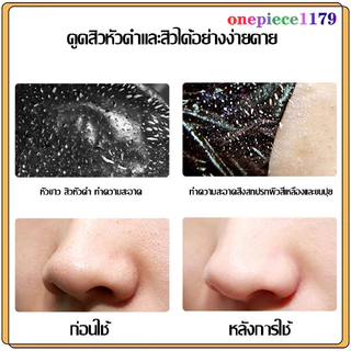 มาส์กหน้าลอกสิวเสี้ยน มาส์กจมูกสิวหัวดำ พอกหน้า แผ่นมาร์คหน้า มาส์กสิวเสี้ยน มาส์กกำจัดสิวหัวดำ sadoer mask60g(743)