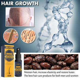 Hair growth castor oil spray สเปรย์ดูแลหนังศรีษะลดการหลุดล่วงของเส้นผม