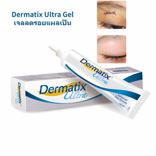 💖(มีสินค้าในไทย) Dermatix Ultra Gel 15g เดอร์มาติกซ์ เจลลดรอยแผลเป็น ลบรอยแผลเป็น สำหรับรอยสิว แผลเผาไหม้ แผลเป็นจากการผ