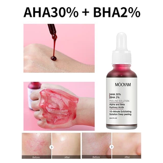 L272 มาส์กแดง หน้าใส AHA MOOYAM AHA 30% + BHA 2% เซรั่มไวท์เทนนิ่ง ผลิตภัณฑ์ดูแลผิวหน้า กําจัดสิว ควบคุมความมัน 30 มล.